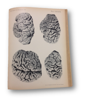 Gustaf Retzius, Das Menschenhirn, vol. 2, (Stockholm, 1896). © National Library of Medicine.